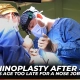 Rhinoplasty After 40 Is Age Too Late for a Nose Job Dr furkan Certel